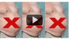 Fat Cavitation Session