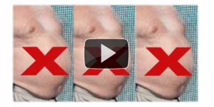 Fat Cavitation Session